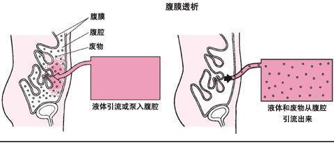 8859f4a0-7b57-11eb-ae6b-c3ca3e3f7798.jpg
